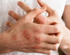 * Glove-allergies.jpg
