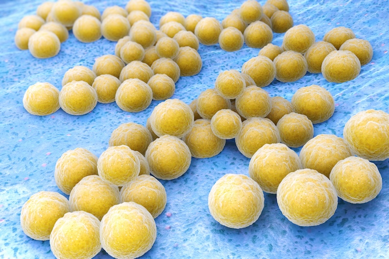 * Hydrachem-hospital-onset-MRSA.jpg